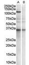 Pumilio homolog 2 antibody, PA5-18355, Invitrogen Antibodies, Western Blot image 