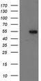 Glucosylceramidase Beta 3 (Gene/Pseudogene) antibody, CF502603, Origene, Western Blot image 