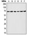 A-Raf Proto-Oncogene, Serine/Threonine Kinase antibody, orb213579, Biorbyt, Western Blot image 