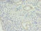 Mediator Complex Subunit 30 antibody, A59782-100, Epigentek, Immunohistochemistry paraffin image 