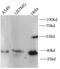 C-X-C Motif Chemokine Receptor 4 antibody, FNab10437, FineTest, Western Blot image 
