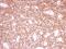 Pre-MRNA Processing Factor 39 antibody, GTX104949, GeneTex, Immunohistochemistry paraffin image 