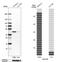 Alpha-Methylacyl-CoA Racemase antibody, HPA019527, Atlas Antibodies, Western Blot image 