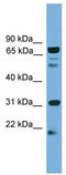 Solute Carrier Family 6 Member 3 antibody, TA334127, Origene, Western Blot image 