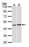 PSMC5 antibody, GTX105347, GeneTex, Western Blot image 
