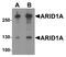 AT-rich interactive domain-containing protein 1A antibody, PA5-72861, Invitrogen Antibodies, Western Blot image 