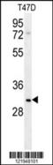 Leucine-rich repeat-containing protein 52 antibody, 62-075, ProSci, Western Blot image 