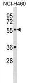 XK Related X-Linked antibody, LS-C160661, Lifespan Biosciences, Western Blot image 