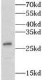Lymphocyte Antigen 6 Family Member K antibody, FNab04899, FineTest, Western Blot image 