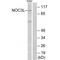 NOC3 Like DNA Replication Regulator antibody, A11293, Boster Biological Technology, Western Blot image 