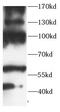 Autotaxin antibody, FNab10430, FineTest, Western Blot image 