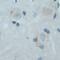 Neurotrophic Receptor Tyrosine Kinase 3 antibody, NB100-98829, Novus Biologicals, Immunohistochemistry frozen image 