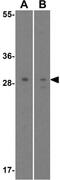 Snail Family Transcriptional Repressor 2 antibody, GTX30813, GeneTex, Western Blot image 