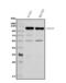 DnaJ Heat Shock Protein Family (Hsp40) Member C6 antibody, A05616-2, Boster Biological Technology, Western Blot image 
