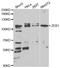 Zinc Finger E-Box Binding Homeobox 1 antibody, TA332781, Origene, Western Blot image 