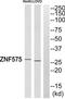 Zinc Finger Protein 575 antibody, TA316315, Origene, Western Blot image 