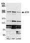 Serine/threonine-protein kinase ATR antibody, A300-138A, Bethyl Labs, Western Blot image 