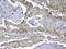 Mediator Complex Subunit 9 antibody, A12781, Boster Biological Technology, Immunohistochemistry frozen image 