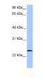 Tctex1 Domain Containing 4 antibody, orb325914, Biorbyt, Western Blot image 