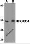 Forkhead Box O4 antibody, 5815, ProSci, Western Blot image 