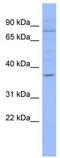 Hypermethylated in cancer 1 protein antibody, TA329703, Origene, Western Blot image 