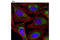 Succinate Dehydrogenase Complex Flavoprotein Subunit A antibody, 11998P, Cell Signaling Technology, Immunofluorescence image 