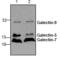 Galectin 9 antibody, TA318971, Origene, Western Blot image 