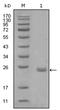 AXL Receptor Tyrosine Kinase antibody, AM06260SU-N, Origene, Western Blot image 