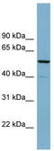CDK5 Regulatory Subunit Associated Protein 1 antibody, TA345027, Origene, Western Blot image 