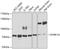 Dual Specificity Tyrosine Phosphorylation Regulated Kinase 1A antibody, GTX64619, GeneTex, Western Blot image 