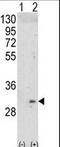 Integral Membrane Protein 2A antibody, LS-C165336, Lifespan Biosciences, Western Blot image 