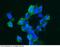 Carbonic Anhydrase 14 antibody, 10458-R515, Sino Biological, Immunohistochemistry paraffin image 