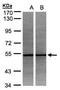 ADP Dependent Glucokinase antibody, NBP1-32429, Novus Biologicals, Western Blot image 