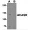 Calcium Sensing Receptor antibody, TA349050, Origene, Western Blot image 