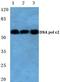 DNA Polymerase Epsilon 2, Accessory Subunit antibody, A09182, Boster Biological Technology, Western Blot image 