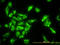 Eukaryotic Translation Elongation Factor 1 Gamma antibody, LS-C197111, Lifespan Biosciences, Immunofluorescence image 