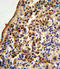 X-Ray Repair Cross Complementing 6 antibody, LS-C165655, Lifespan Biosciences, Immunohistochemistry paraffin image 