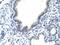 Nucleolar RNA helicase 2 antibody, A04605-1, Boster Biological Technology, Immunohistochemistry paraffin image 