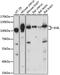 Advillin antibody, A15785, ABclonal Technology, Western Blot image 