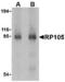 CD180 antigen antibody, TA306326, Origene, Western Blot image 