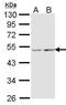 Cytochrome C Oxidase Assembly Homolog COX15 antibody, PA5-34681, Invitrogen Antibodies, Western Blot image 