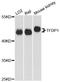 Transcription Factor Dp-1 antibody, STJ27375, St John
