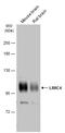 Leucine Rich Repeat Containing 4 antibody, GTX133276, GeneTex, Western Blot image 