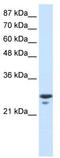 Transcription Factor A, Mitochondrial antibody, TA329264, Origene, Western Blot image 
