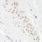 BCL9 Transcription Coactivator antibody, 22-491, ProSci, Immunohistochemistry frozen image 