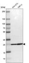 Proteasome Subunit Alpha 2 antibody, PA5-52527, Invitrogen Antibodies, Western Blot image 