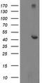 AP2M1 antibody, LS-C173014, Lifespan Biosciences, Western Blot image 