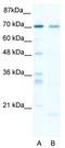 SRY-Box 13 antibody, TA334239, Origene, Western Blot image 