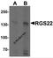 Regulator Of G Protein Signaling 22 antibody, 7001, ProSci Inc, Western Blot image 
