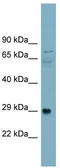 Dystroglycan 1 antibody, TA339411, Origene, Western Blot image 